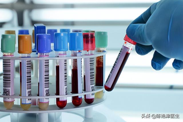 血液全套检查项目有哪些项目，血常规检查项目有哪些？